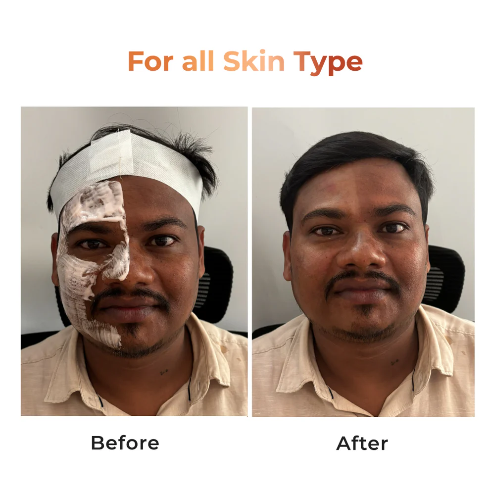 Niconi Tan Vanish Gluta-Kojic Skin Polish 180g (₹80 per use)