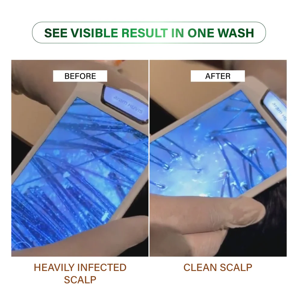 Niconi JADTATVA Herbal Hair Oil Spray (200ml)