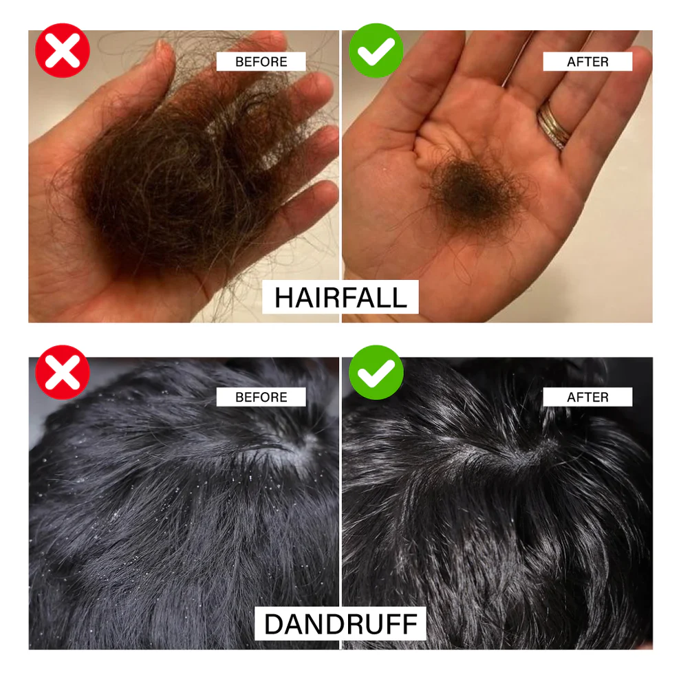 Niconi JADTATVA Herbal Hair Oil Spray (200ml)