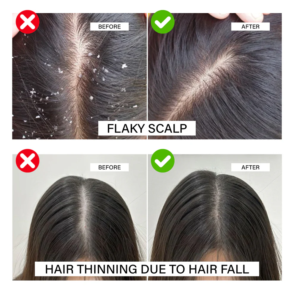 Niconi JADTATVA Herbal Hair Oil Spray (200ml)